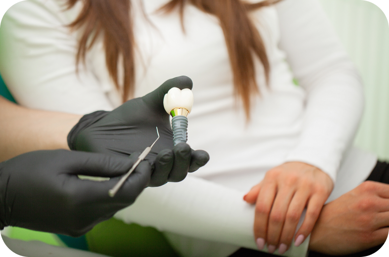 Modèle d'implant dentaire utilisé pour expliquer le traitement au patient